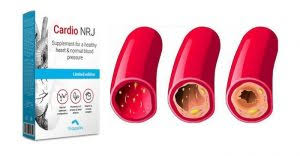 Cardio Nrj – lékárna – účinky – výrobce